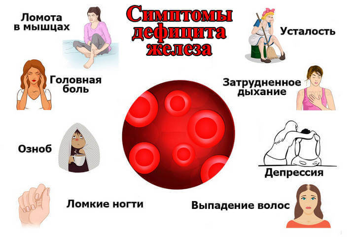 АНЕМИЯ: Как понять, что вашему организму не хватает железа АНЕМИЯ: Как понять, что вашему организму не хватает железа