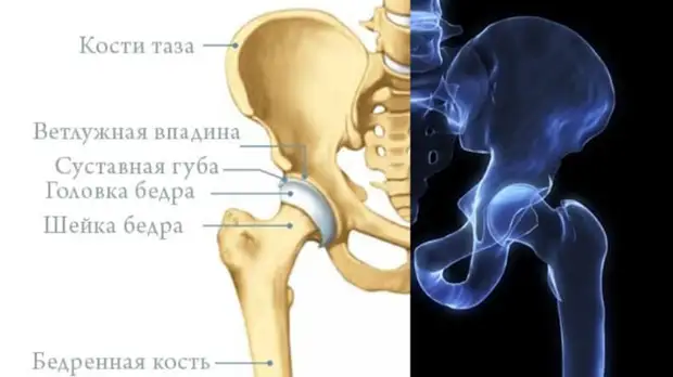 Почему болит в тазобедренном суставе
