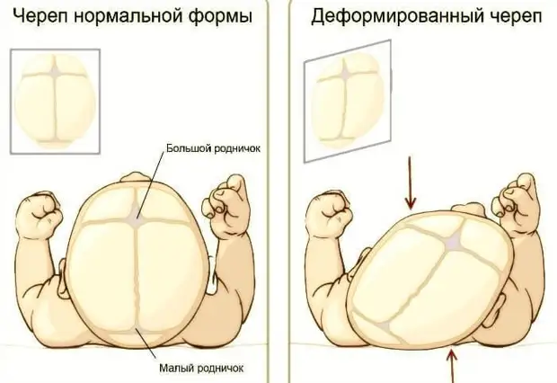 Лечение дисфункций височно-нижнечелюстного сустава