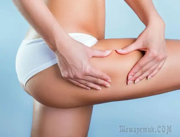Как избавиться от целлюлита на ногах, бедрах, ягодицах, руках