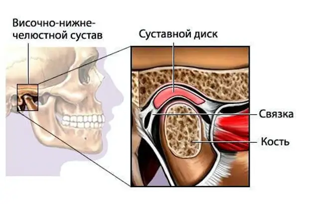 Лечение дисфункций височно-нижнечелюстного сустава