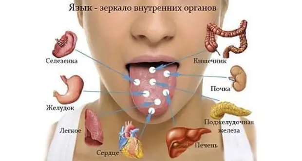 Что язык расскажет о ваших болезнях