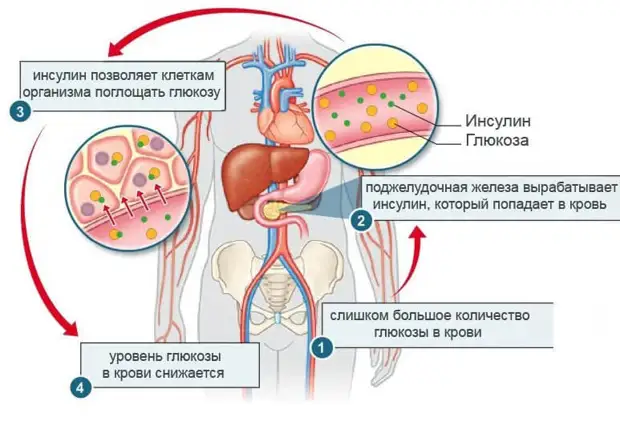 Как понять, что у вас повышен инсулин