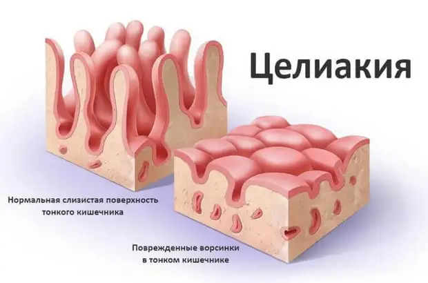 Как пшеница влияет на здоровье