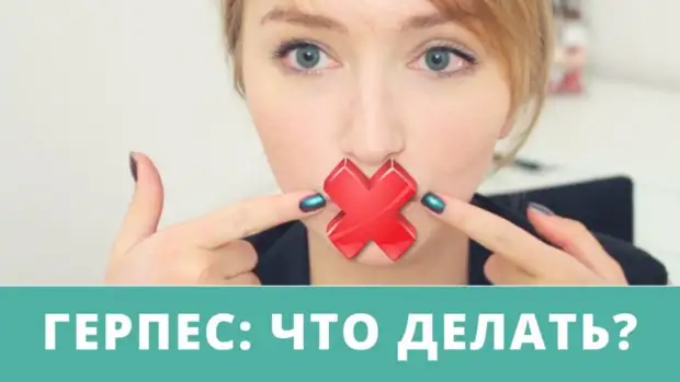 Простуда на губе — как избавиться от язв на губах