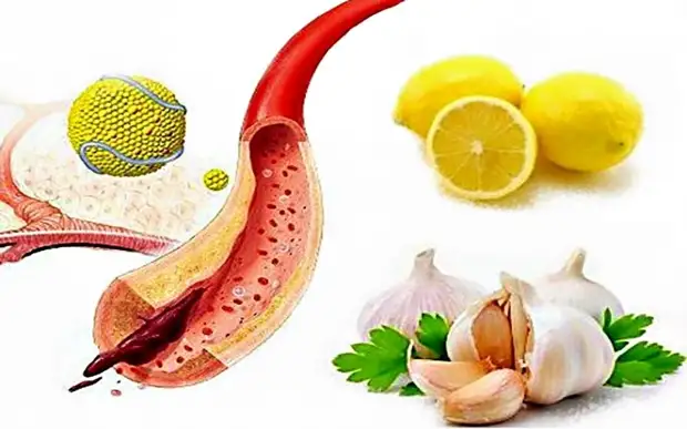 6 правил питания для здоровых сосудов и обзор продуктов для их укрепления и очищения