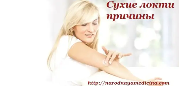 Почему сухие локти? Сухая кожа на локтях и коленях. Причины. Лечение.