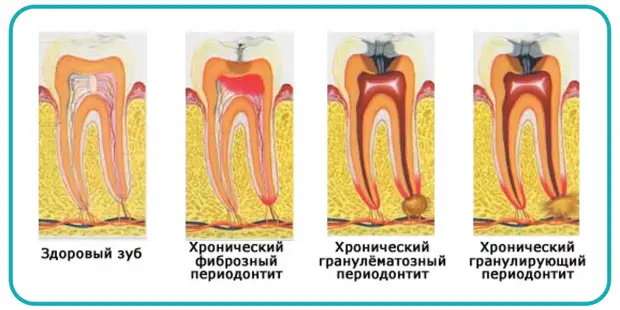Привычки, которые могут оказаться смертельно опасными