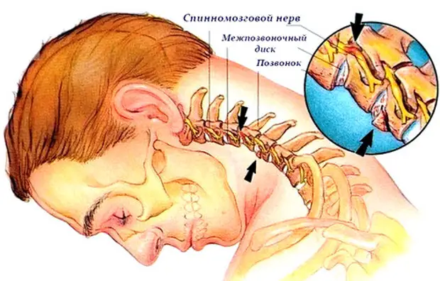 Что делать, если болит шея