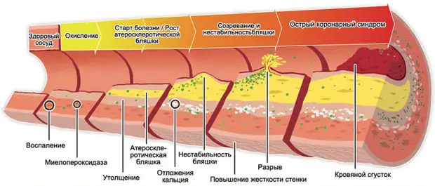 Факты о холестерине, о которых мало кто знает