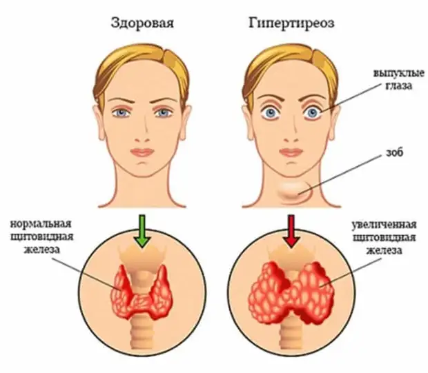 Почему  дрожат руки