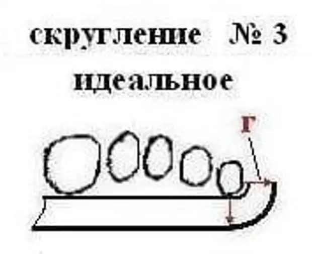 Как исправить плоскостопие и косолапие